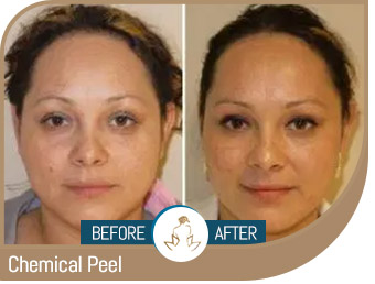 Before and After Gallery of True Laser Spa in Saint Clair Shores, MI Before and After Gallery of True Laser Spa in Saint Clair Shores, MI
