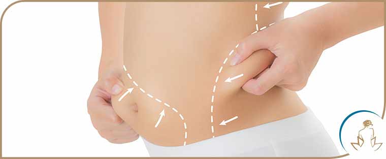Laser Fat Removal Treatment Near Me in Saint Clair Shores, MI Laser Fat Removal Treatment Near Me in Saint Clair Shores, MI