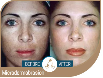 Before and After Gallery of True Laser Spa in Saint Clair Shores, MI Before and After Gallery of True Laser Spa in Saint Clair Shores, MI