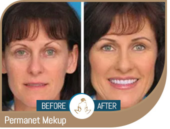 Before and After Gallery of True Laser Spa in Saint Clair Shores, MI Before and After Gallery of True Laser Spa in Saint Clair Shores, MI