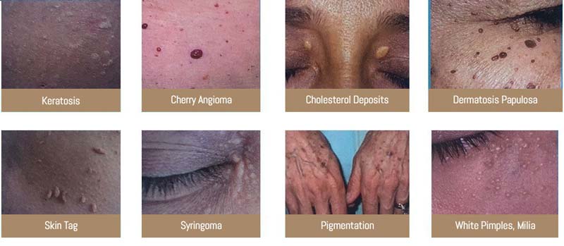 Perfect Touch Procedure Near Me in Saint Clair Shores, MI Perfect Touch Procedure Near Me in Saint Clair Shores, MI